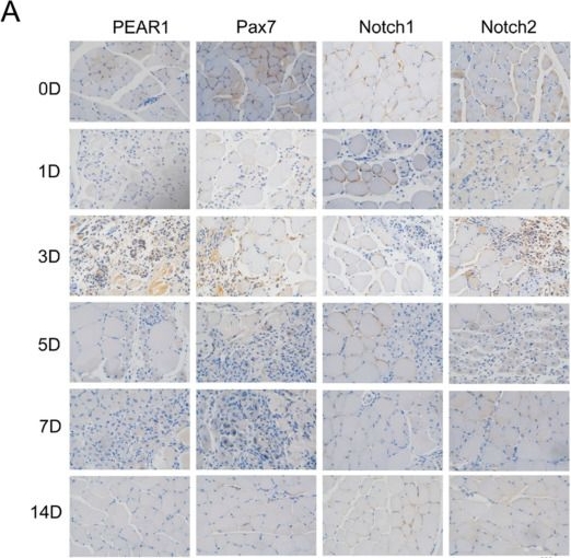 Fig.7.A showing Immunohistochemistry in a Mus musculus (House mouse) sample from the publication: PEAR1 Promotes Myoblast Proliferation Through Notch Signaling Pathway.