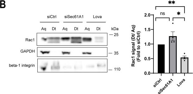 Fig.3.B showing Western Blotting from the publication: Screening of gene function in cell intoxication by CNF1 links Sec61 translocon to Rac1 GTPase activity.
