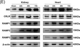 Fig.1.E showing Western Blotting from the publication: Intermedin prevents acute heart failure following acute kidney injury by alleviating inflammatory responses.