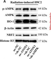 Fig.4.A showing Western Blotting in a Homo sapiens (Human) sample from the publication: ATOX1 alleviates radiation-induced cardiac injury by modulating AMPK/NRF2 to inhibit myocardial oxidative stress and mitochondrial dysfunction.