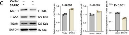 Fig.5.C showing Western Blotting in a Homo sapiens (Human) sample from the publication: SPARC modulates macrophage-like phenotype transformation in VSMCs and triggers a vicious cycle.