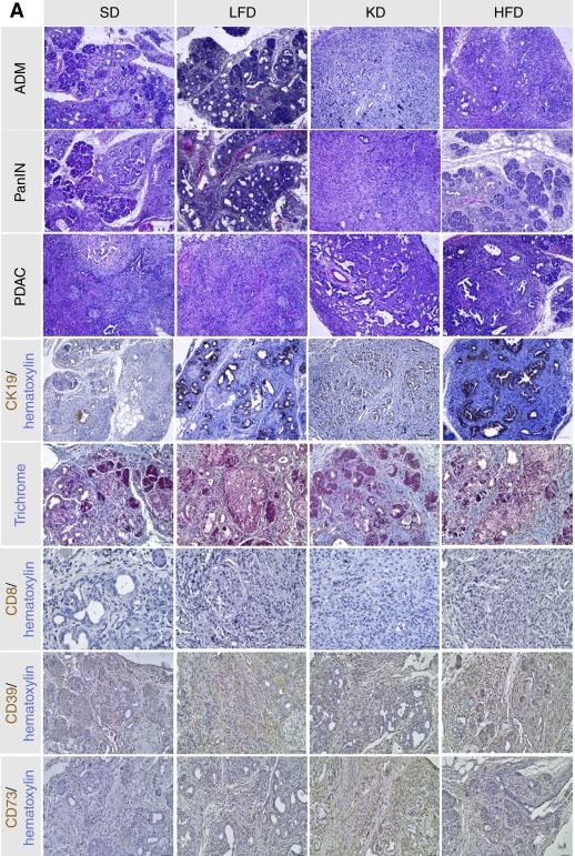Fig.3.A showing Immunohistochemistry in a Mus musculus (House mouse) sample from the publication: Dietary Fat Content Influences PanIN Progression and Pancreatic Cancer Development in Mice.