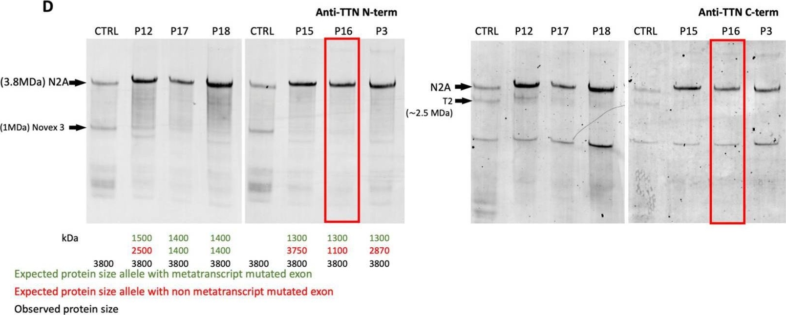 Fig.3.D showing Western Blotting in a Homo sapiens (Human) sample from the publication: Congenital Titinopathies Linked to Mutations in TTN Metatranscript-Only Exons.