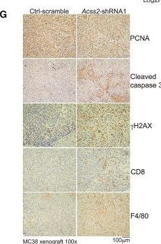 Fig.2.G showing Immunohistochemistry in a Mus musculus (House mouse) sample from the publication: ACSS2 is required for colorectal cancer progression and a druggable target for colorectal cancer treatment.