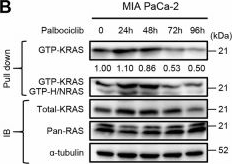 Fig.3.B showing Western Blotting in a Mus musculus (House mouse) sample from the publication: Deprivation of EGFR signal causes senolysis in PDAC with CDK4/6 inhibition.