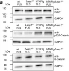 Fig.4.A showing Western Blotting in a Mus musculus (House mouse) sample from the publication: Lasp1 regulates adherens junction dynamics and fibroblast transformation in destructive arthritis.