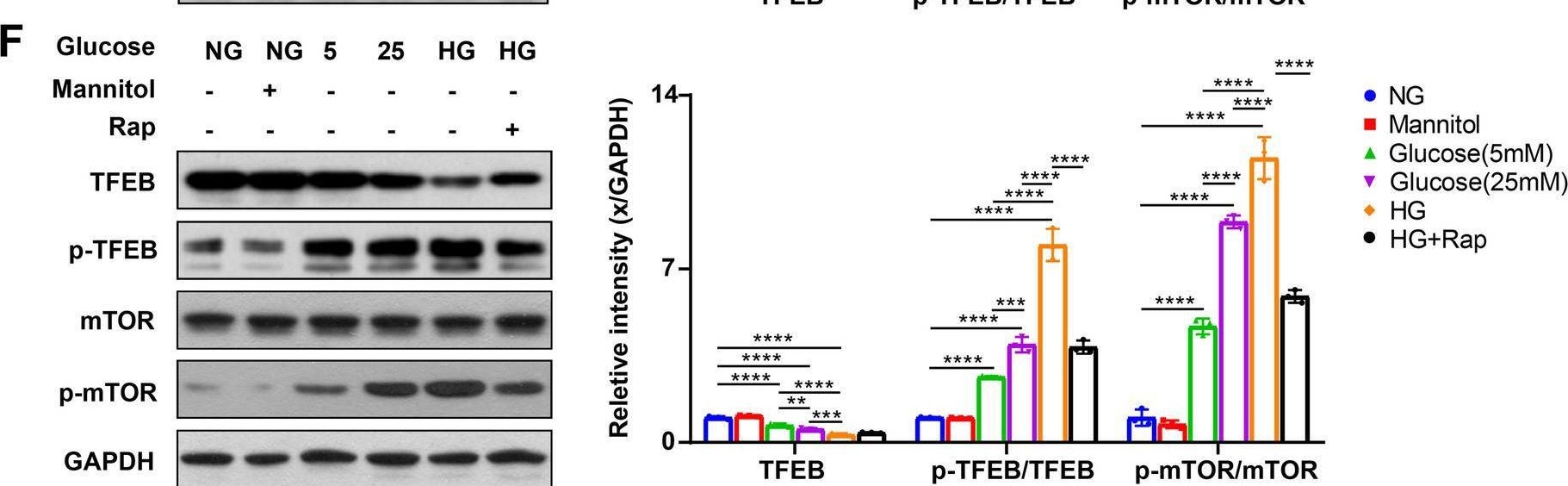 Fig.3.F showing Western Blotting in a Mus musculus (House mouse) sample from the publication: mTOR-dependent TFEB activation and TFEB overexpression enhance autophagy-lysosome pathway and ameliorate Alzheimer's disease-like pathology in diabetic encephalopathy.