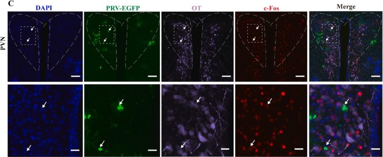 Fig.9.C showing Immunohistochemistry-immunofluorescence in a Mus musculus (House mouse) sample from the publication: Mapping of uterine-related neurons in central nervous system of mice by trans-synaptic tracing with pseudorabies virus.