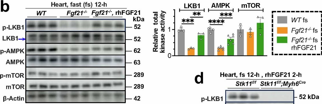 Fig.7.B showing Western Blotting in a Mus musculus (House mouse) sample from the publication: A two-strata energy flux system driven by a stress hormone prioritizes cardiac energetics.