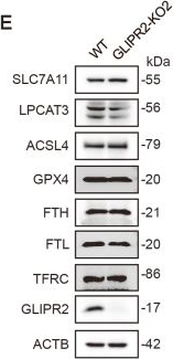 Fig.6.E showing Western Blotting from the publication: Application of a novel myristoylproteomics approach identifies GLIPR2 as a key pro-ferroptotic substrate in non-small cell lung cancer.