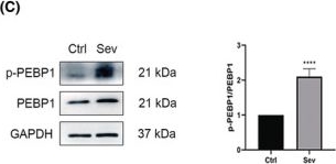 Fig.3.C showing Western Blotting in a Rattus norvegicus (Rat) sample from the publication: Multiple sevoflurane exposures during mid-trimester induce neurotoxicity in the developing brain initiated by 15LO2-Mediated ferroptosis.