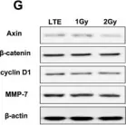 Fig.3.G showing Western Blotting from the publication: Axin gene methylation status correlates with radiosensitivity of lung cancer cells.