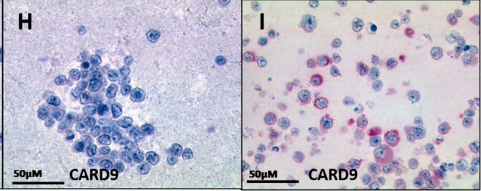 Fig.2.H showing Immunohistochemistry in an Armoracia rusticana (Horseradish) sample from the publication: CARD9 Forms an Alternative CBM Complex in Richter Syndrome.