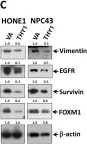 Fig.2.C showing Western Blotting from the publication: THY1 (CD90) Maintains the Adherens Junctions in Nasopharyngeal Carcinoma via Inhibition of SRC Activation.