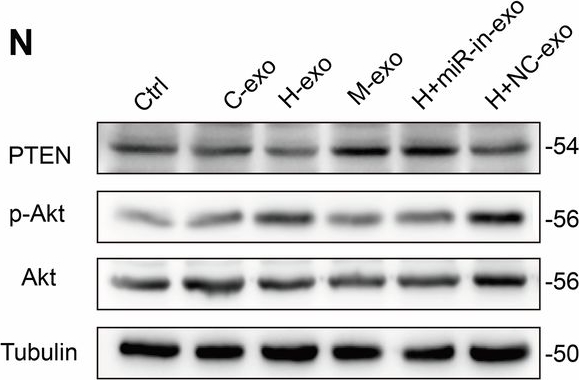 Fig.7.N showing Western Blotting in a Homo sapiens (Human) sample from the publication: TRIM27-controlled endothelium-derived exosomes play a central role in podocyte injury in diabetic kidney disease.