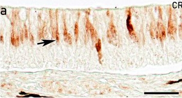 Fig.10.A showing Immunohistochemistry in a Solea senegalensis (Senegalese sole) sample from the publication: Integrated Histological, Ultrastructural, Lectin and Immunohistochemical Characterization of the Senegalese sole (Solea senegalensis) Olfactory Rosettes: From Premetamorphic Larvae to Adult Individuals.