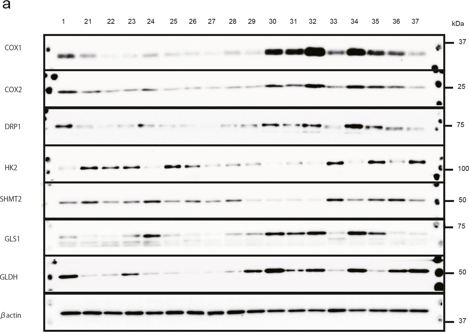Fig.3.A showing Western Blotting from the publication: Glutaminolysis is associated with mitochondrial pathway activation and can be therapeutically targeted in glioblastoma.