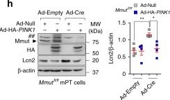 Fig.7.H showing Western Blotting in a Homo sapiens (Human) sample from the publication: Impaired mitophagy links mitochondrial disease to epithelial stress in methylmalonyl-CoA mutase deficiency.