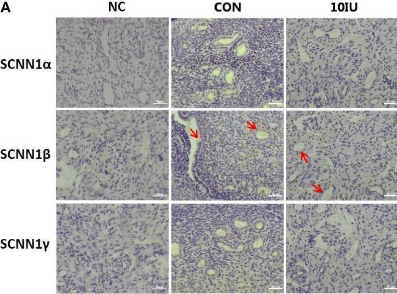 Fig.9.A showing Immunohistochemistry from the publication: Adverse effect of assisted reproductive technology-related hyperoestrogensim on the secretion and absorption of uterine fluid in superovulating mice during the peri-implantation period.