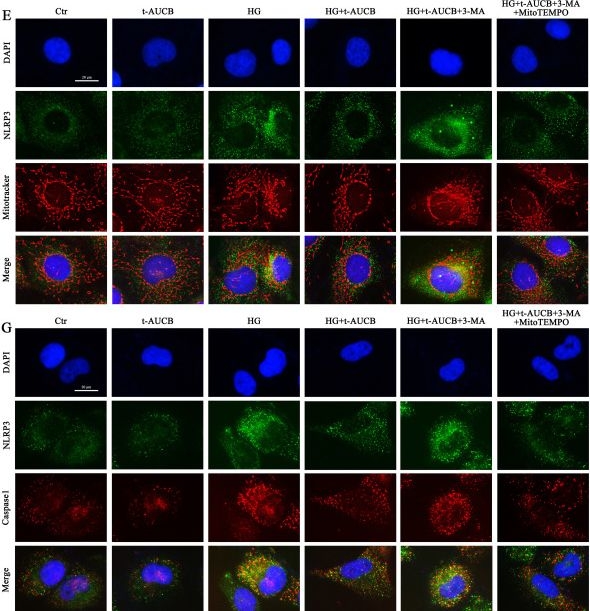 Fig.8.E showing Immunocytochemistry-immunofluorescence from the publication: sEH inhibition attenuates mtROS-mediated NLRP3 inflammasome activation by promoting mitophagy in tubular epithelial cells in diabetic kidney disease.