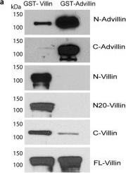 Fig.1.A showing Western Blotting in a Mus musculus (House mouse) sample from the publication: Mouse intestinal tuft cells express advillin but not villin.