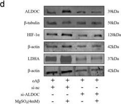 Fig.6.D showing Western Blotting in a Homo sapiens (Human) sample from the publication: ALDOC modulates astrocytic glycolysis and AMPK/mTOR/HIF-1α signaling in Alzheimer's disease.