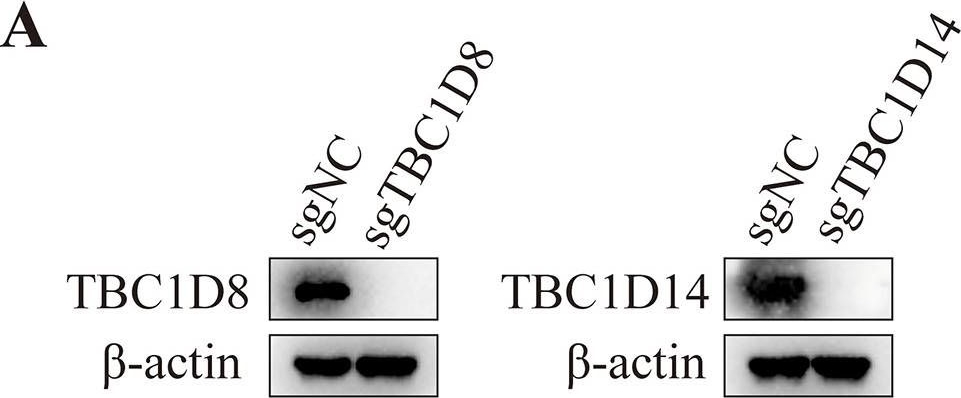 Fig.9.A showing Western Blotting in a Homo sapiens (Human) sample from the publication: A comprehensive analysis of the oncogenic and prognostic role of TBC1Ds in human hepatocellular carcinoma.