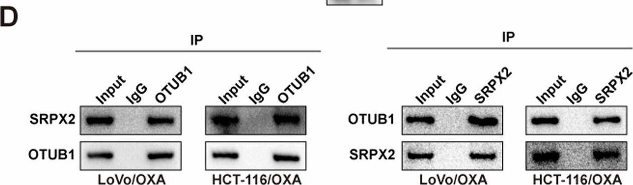 Fig.6.D showing Western Blotting in a Homo sapiens (Human) sample from the publication: CircSEC24B activates autophagy and induces chemoresistance of colorectal cancer via OTUB1-mediated deubiquitination of SRPX2.