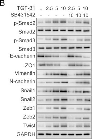 Fig.1.B showing Western Blotting in a Homo sapiens (Human) sample from the publication: A FoxM1/Smad4 positive feedback loop promotes pancreatic cancer progression.