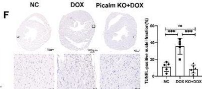 Fig.6.F showing Immunohistochemistry in a Mus musculus (House mouse) sample from the publication: PICALM Regulating the Generation of Amyloid β-Peptide to Promote Anthracycline-Induced Cardiotoxicity.
