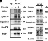 Fig.2.A showing Western Blotting in a Homo sapiens (Human) sample from the publication: BICD1 mediates HIF1α nuclear translocation in mesenchymal stem cells during hypoxia adaptation.