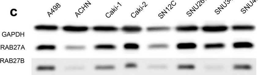 Fig.1.C showing Western Blotting in a Homo sapiens (Human) sample from the publication: Exosome-mediated secretion of miR-127-3p regulated by RAB27A accelerates metastasis in renal cell carcinoma.