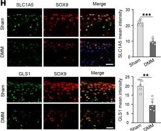Fig.1.H showing Immunocytochemistry-immunofluorescence in a Mus musculus (House mouse) sample from the publication: α-Ketoglutarate protects against cartilage damage via epigenetically driven metabolic reprogramming in osteoarthritis models.