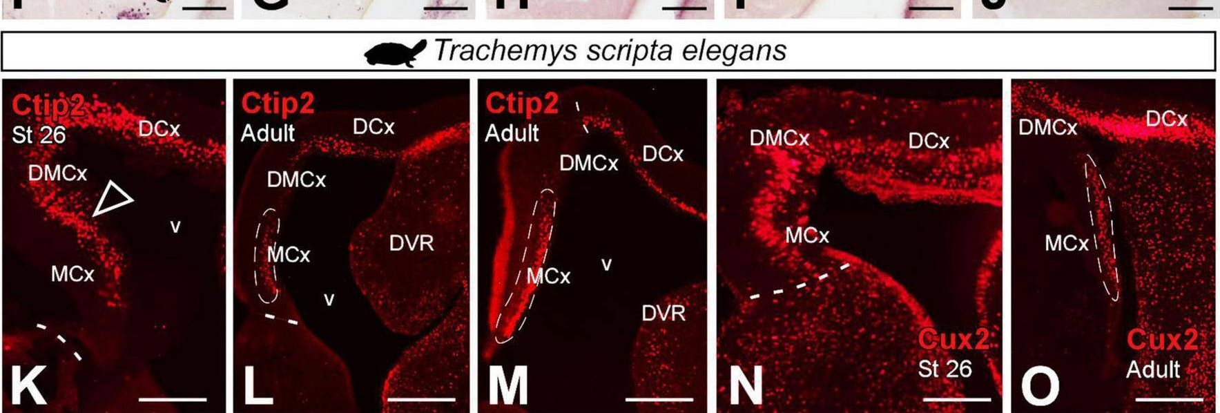 Fig.11.F showing Immunohistochemistry-immunofluorescence in a Xenopus laevis (African clawed frog) sample from the publication: Development of subdomains in the medial pallium of Xenopus laevis and Trachemys scripta: Insights into the anamniote-amniote transition.