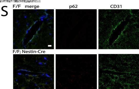 Impaired mitochondrial accumulation and Lewy pathology in neuron-specific FBXO7-deficient mice.