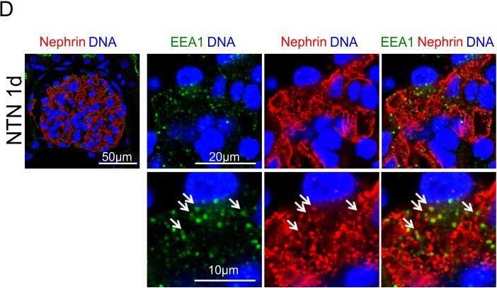 A novel in vivo method to quantify slit diaphragm protein abundance in murine proteinuric kidney disease.