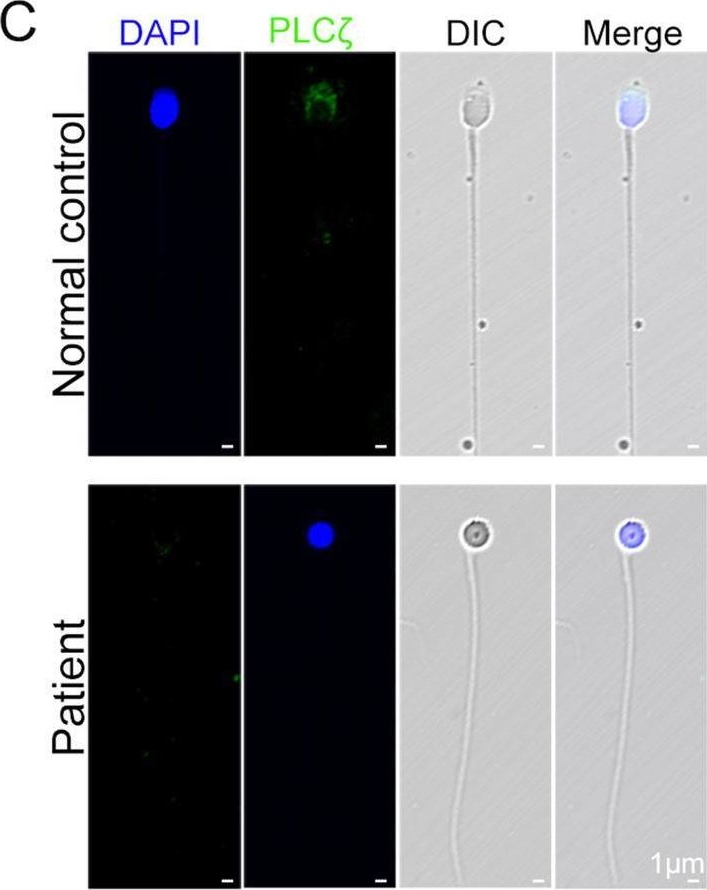 Fig.5.C showing Immunocytochemistry-immunofluorescence from the publication: A loss-of-function variant in SSFA2 causes male infertility with globozoospermia and failed oocyte activation.