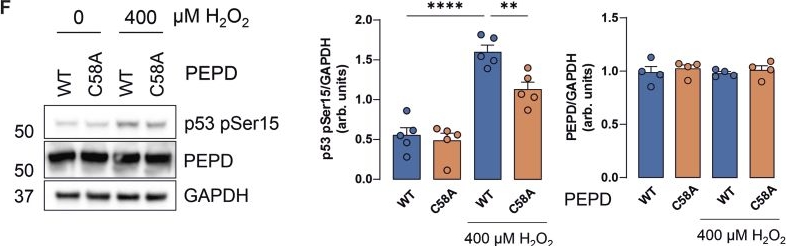 Fig.4.F showing Western Blotting in a Homo sapiens (Human) sample from the publication: ReDisulphID: A discovery platform for thiol redox sensors identifies a druggable site regulating p53 activation.