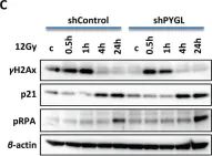 Fig.3.C showing Western Blotting from the publication: Liver glycogen phosphorylase is upregulated in glioblastoma and provides a metabolic vulnerability to high dose radiation.
