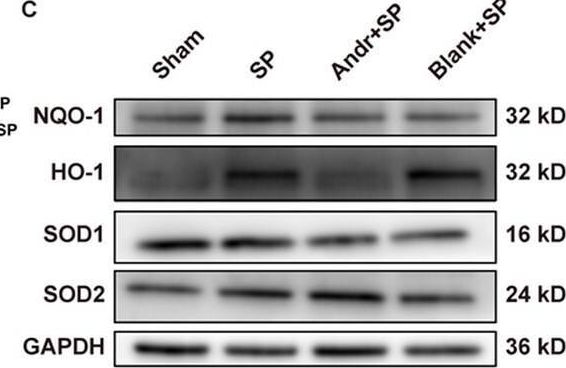 Fig.5.C showing Western Blotting from the publication: Enhanced prevention on postoperative atrial fibrillation by using anti-inflammatory biodegradable drug patch.