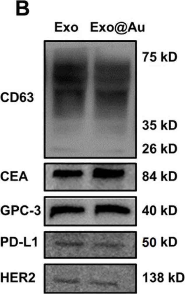 Fig.3.B showing Western Blotting in a Homo sapiens (Human) sample from the publication: Nanozyme-assisted sensitive profiling of exosomal proteins for rapid cancer diagnosis.