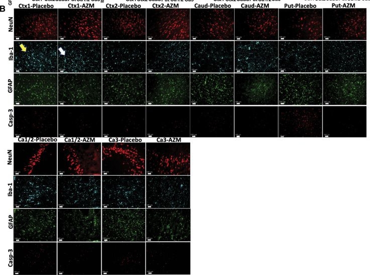 Fig.4.B showing Immunocytochemistry-immunofluorescence in an Ovis aries (Sheep) sample from the publication: Perinatal Azithromycin Provides Limited Neuroprotection in an Ovine Model of Neonatal Hypoxic-Ischemic Encephalopathy.