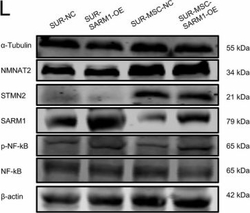 Fig.5.L showing Western Blotting from the publication: hUC-MSCs via β-NGF Alleviate Cognitive Impairment After Tibial Fracture Surgery by Regulating the STMN2/NMNAT2-SARM1-NF-κB Signaling Pathway.