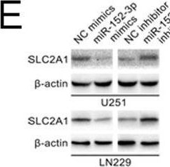 Fig.5.M showing Western Blotting from the publication: Long non-coding RNA LINC00174 promotes glycolysis and tumor progression by regulating miR-152-3p/SLC2A1 axis in glioma.