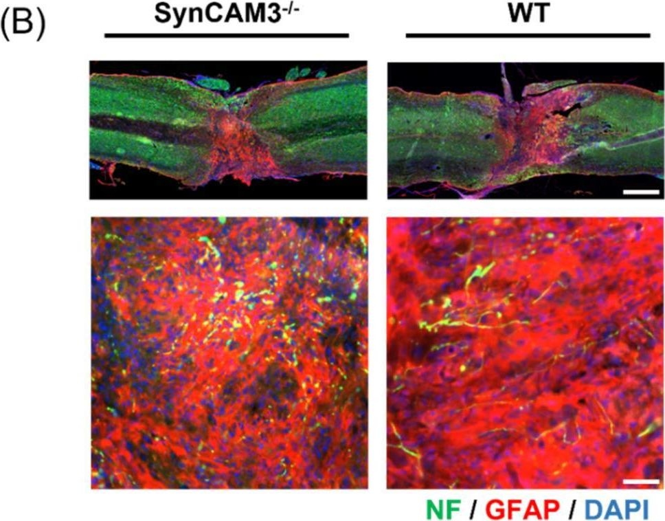 Fig.4.B showing Immunohistochemistry-immunofluorescence in a Mus musculus (House mouse) sample from the publication: Synaptic Cell Adhesion Molecule 3 (SynCAM3) Deletion Promotes Recovery from Spinal Cord Injury by Limiting Glial Scar Formation.