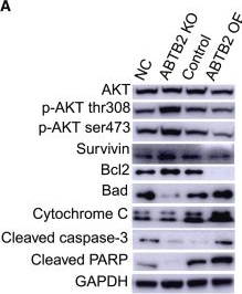 Fig.7.A showing Western Blotting from the publication: Mechanistic and functional characterization of ABTB2 as a novel target for pancreatic cancer therapy.