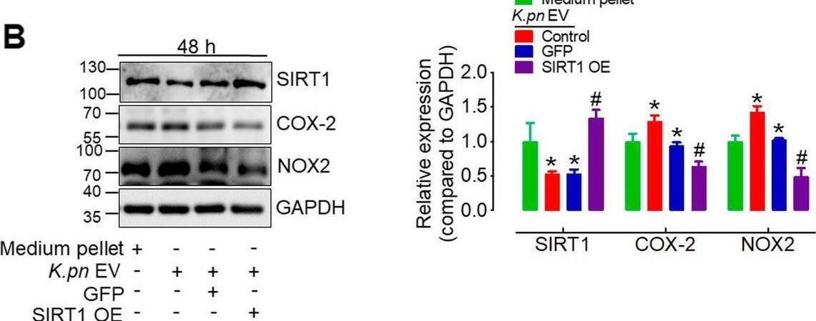 Fig.7.B showing Western Blotting in a Homo sapiens (Human) sample from the publication: Klebsiella pneumoniae-derived extracellular vesicles impair endothelial function by inhibiting SIRT1.