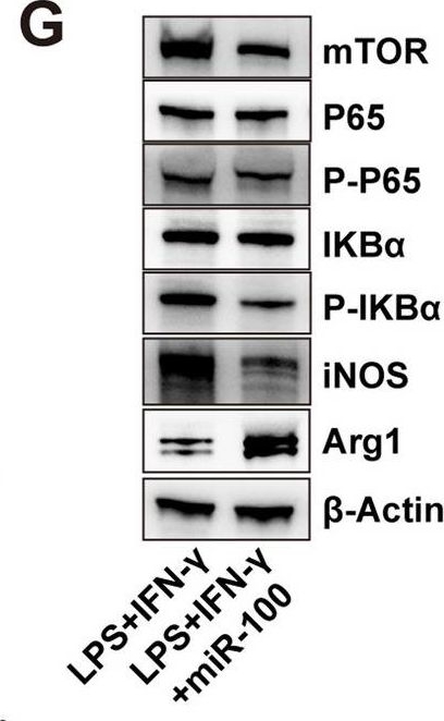 Fig.8.G showing Western Blotting in a Homo sapiens (Human) sample from the publication: Extracellular vesicles derived from human ESC-MSCs target macrophage and promote anti-inflammation process, angiogenesis, and functional recovery in ACS-induced severe skeletal muscle injury.