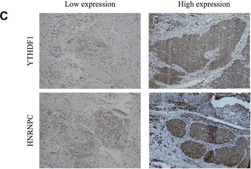 Fig.6.C showing Immunohistochemistry in a Homo sapiens (Human) sample from the publication: Identification of m6a-related signature genes in esophageal squamous cell carcinoma by machine learning method.
