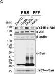 Fig.1.C showing Western Blotting from the publication: The c-Abl inhibitor, Radotinib HCl, is neuroprotective in a preclinical Parkinson's disease mouse model.